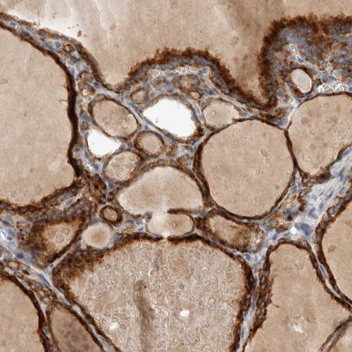 Immunohistochemical staining of human thyroid gland shows strong cytoplasmic positivity in glandular cells.