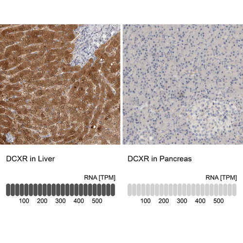Immunohistochemistry analysis in human liver and pancreas tissues using Anti-DCXR antibody. Corresponding DCXR RNA-seq data are presented for the same tissues.