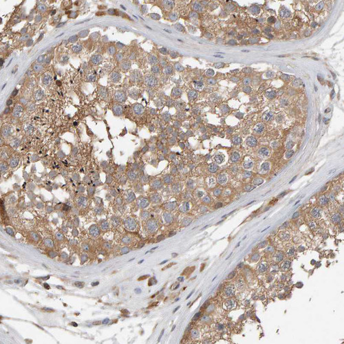 Immunohistochemical staining of human testis shows moderate cytoplasmic positivity in cells in seminiferous ducts.