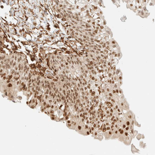 Immunohistochemical staining of human urinary bladder shows strong nuclear positivity in urothelial cells.