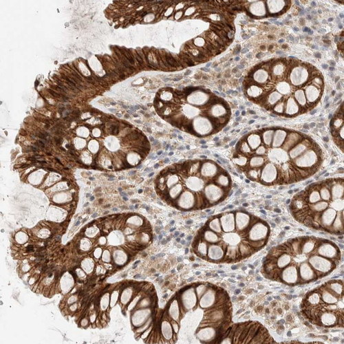 Immunohistochemical staining of human colon shows strong cytoplasmic and nuclear positivity in glandular cells.