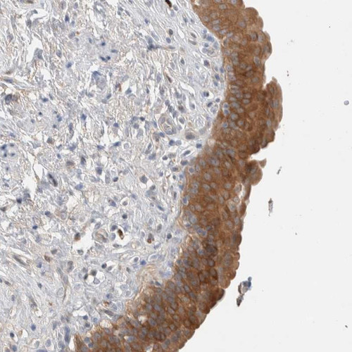 Immunohistochemical staining of human urinary bladder shows strong cytoplasmic positivity in urothelial cells.
