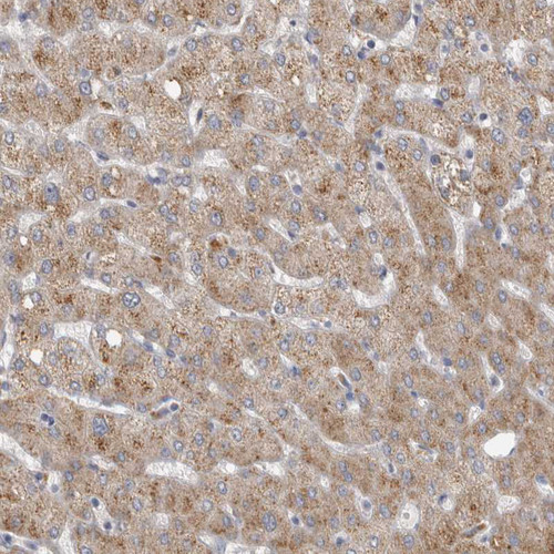 Immunohistochemical staining of human liver shows moderate granular cytoplasmic positivity in hepatocytes.