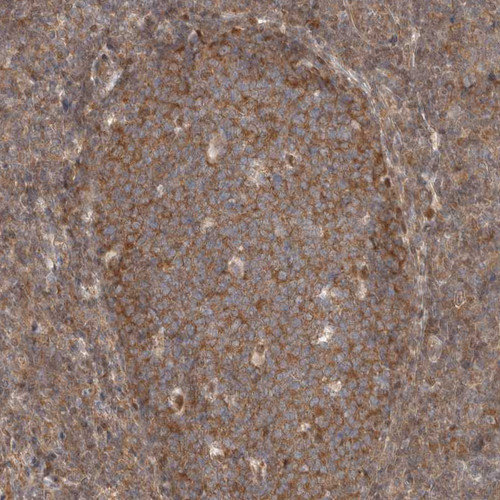 Immunohistochemical staining of human pancreas shows moderate cytoplasmic positivity in exocrine cells.