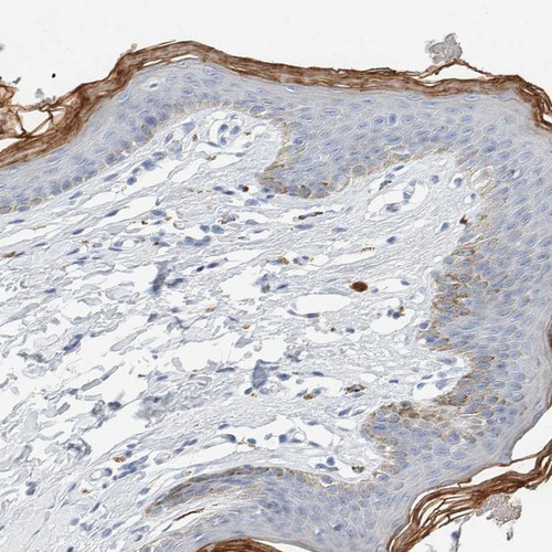 Immunohistochemical staining of human skin shows strong cytoplasmic positivity in keratinocytes.