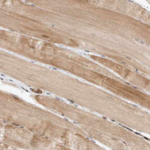 Immunohistochemical staining of human skeletal muscle shows moderate cytoplasmic positivity in myocytes.