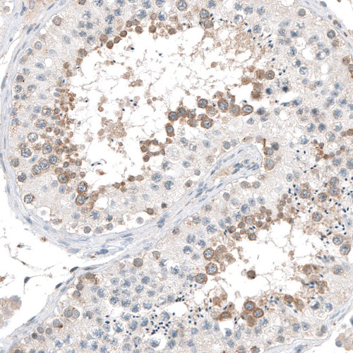 Immunohistochemical staining of human testis shows cytoplasmic positivity in cells in seminiferous ducts.