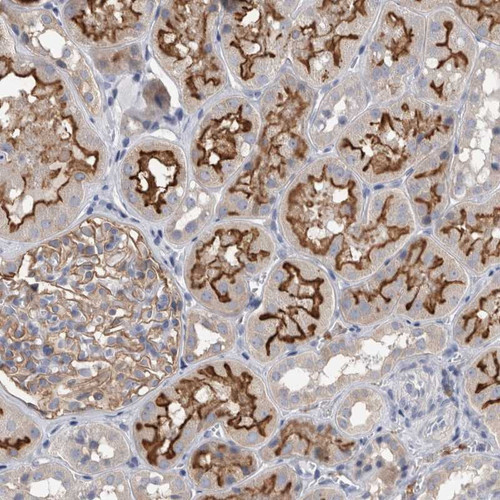 Immunohistochemical staining of human kidney shows distinct membranous positivity in tubular cells.
