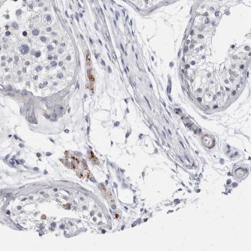 Immunohistochemical staining of human testis shows moderate cytoplasmic positivity in Leydig cells.
