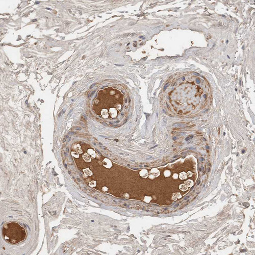 Immunohistochemical staining of human epididymis shows strong positivity in plasma in blood vessels.