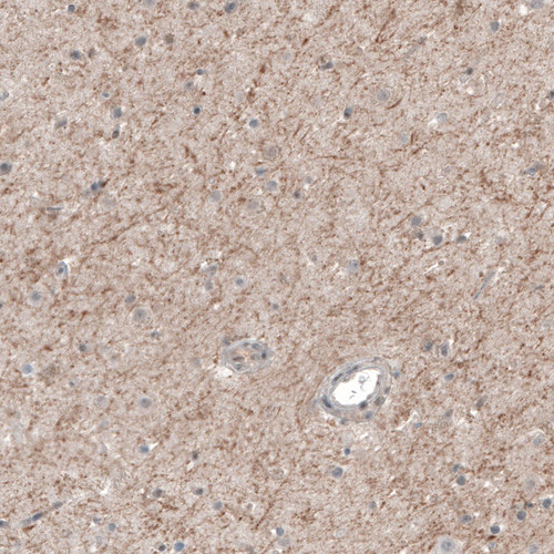 Immunohistochemical staining of human cerebral cortex shows moderate positivity in neuronal processes.