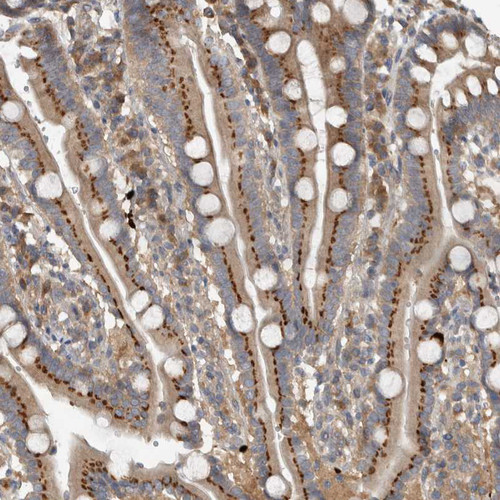 Immunohistochemical staining of human duodenum shows moderate granular cytoplasmic positivity in glandular cells.