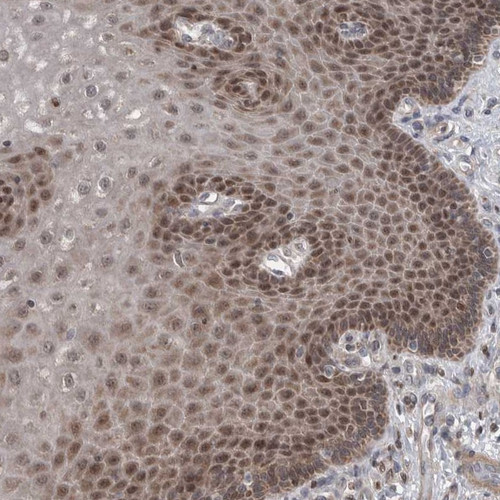 Immunohistochemical staining of human esophagus shows moderate nuclear and cytoplasmic positivity in squamous epithelial cells.