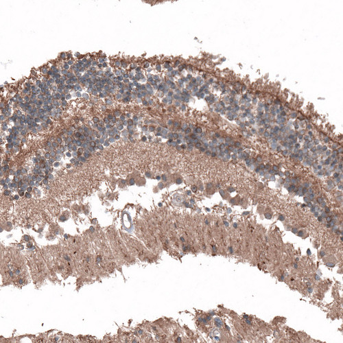 Immunohistochemical staining of human eye, retina shows cytoplasmic positivity in photoreceptor cells.
