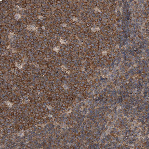 Immunohistochemical staining of human tonsil shows strong cytoplasmic positivity in germinal center cells.