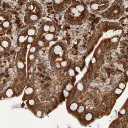 Immunohistochemical staining of human duodenum shows strong cytoplasmic positivity in glandular cells.