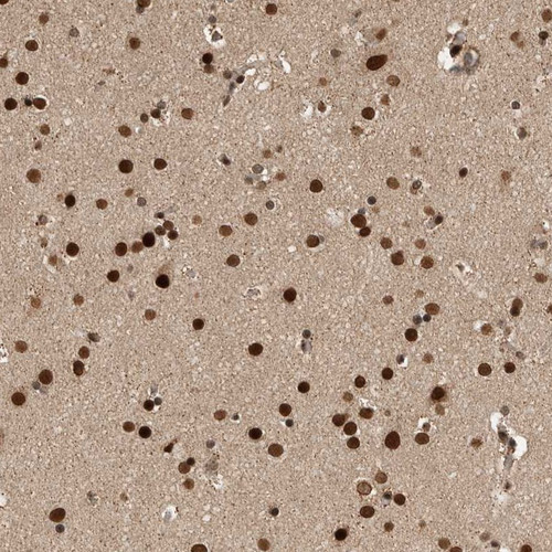 Immunohistochemical staining of human cerebral cortex shows strong nuclear positivity in neuronal and glial cells.