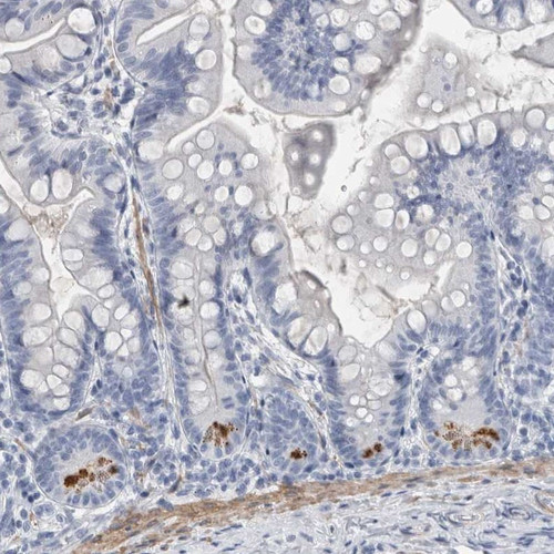 Immunohistochemical staining of human small intestine shows strong positivity in paneth cells.