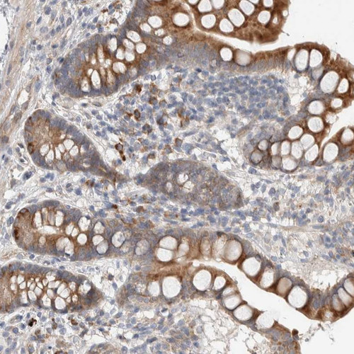 Immunohistochemical staining of human small intestine shows strong cytoplasmic positivity in glandular cells.