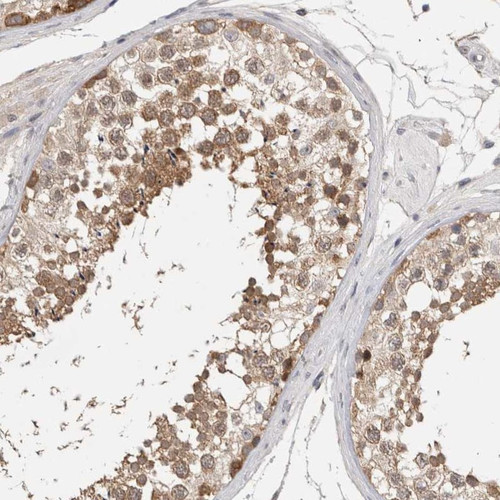 Immunohistochemical staining of human testis shows moderate cytoplasmic positivity in cells in seminiferous ducts.