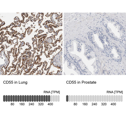 Immunohistochemistry analysis in human lung and prostate tissues using HPA024386 antibody. Corresponding CD55 RNA-seq data are presented for the same tissues.