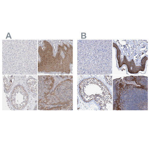 Immunohistochemical staining of human liver, skin, testis and tonsil using Anti-BICD2 antibody HPA024452 (A) shows similar protein distribution across tissues to independent antibody HPA023013 (B).