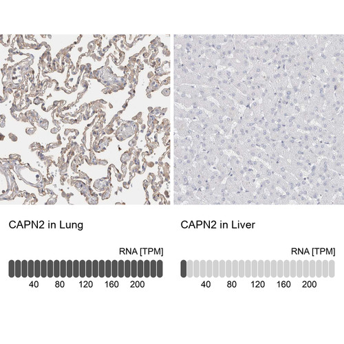 Immunohistochemistry analysis in human lung and liver tissues using HPA024470 antibody. Corresponding CAPN2 RNA-seq data are presented for the same tissues.