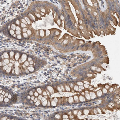 Immunohistochemical staining of human colon shows moderate cytoplasmic positivity in glandular cells.