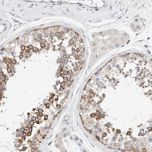 Immunohistochemical staining of human testis shows strong cytoplasmic positivity in seminiferous ducts.