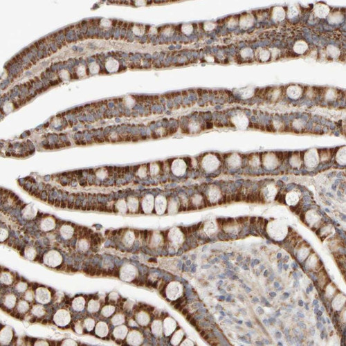 Immunohistochemical staining of human colon shows strong cytoplasmic positivity in glandular cells.