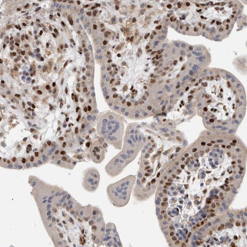 Immunohistochemical staining of human placenta shows strong nuclear positivity in trophoblastic cells.