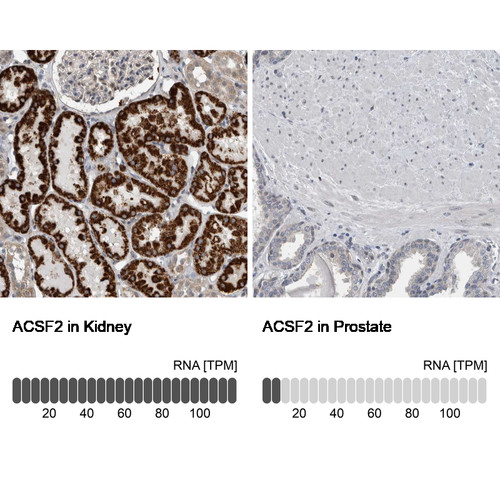 Immunohistochemistry analysis in human kidney and smooth muscle tissues using Anti-ACSF2 antibody. Corresponding ACSF2 RNA-seq data are presented for the same tissues.