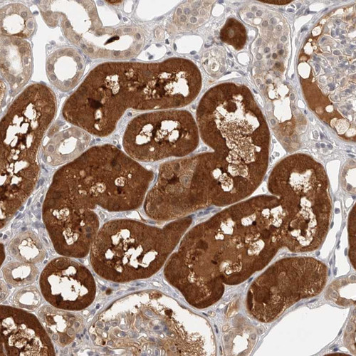 Immunohistochemical staining of human kidney shows strong cytoplasmic positivity in tubular cells.