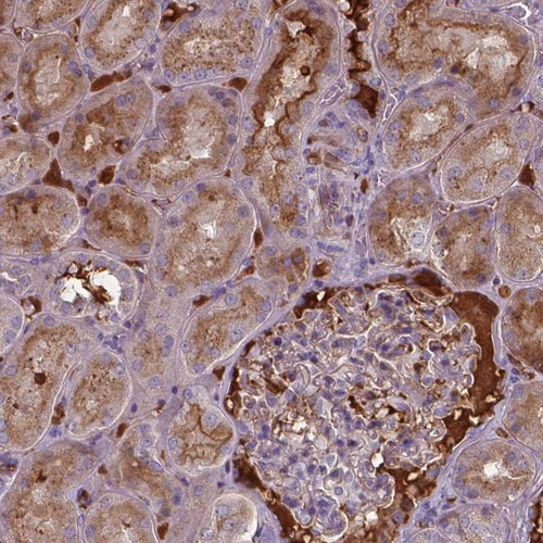 Immunohistochemical staining of human kidney shows moderate cytoplasmic positivity in cells in tubules along with distinctly stained extracellular material.
