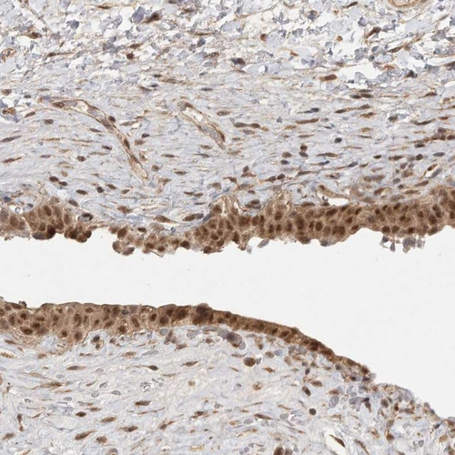 Immunohistochemical staining of human urinary bladder shows nuclear and cytoplasmic positivity in urothelial cells.