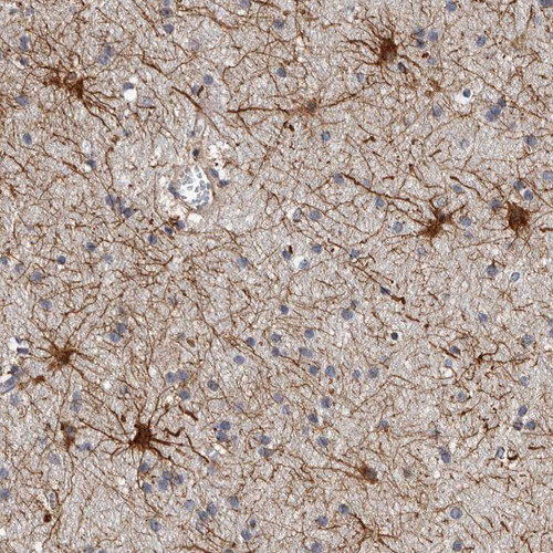 Immunohistochemical staining of human cerebral cortex shows strong cytoplasmic positivity in asterocyte-like cells.