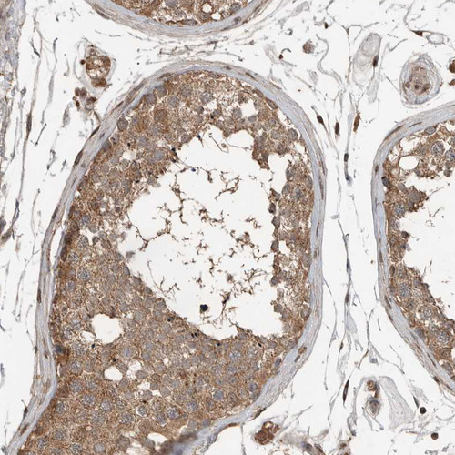Immunohistochemical staining of human testis shows moderate granular cytoplasmic positivity in cells in seminiferous ducts.