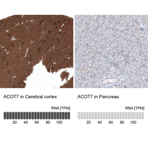 Immunohistochemistry analysis in human cerebral cortex and pancreas tissues using HPA025762 antibody. Corresponding ACOT7 RNA-seq data are presented for the same tissues.