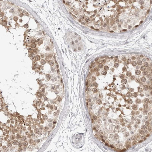 Immunohistochemical staining of human testis shows moderate positivity in cells in seminiferus ducts.