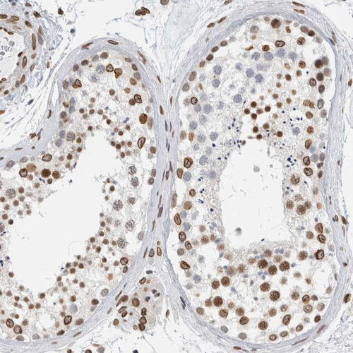 Immunohistochemical staining of human testis shows strong nuclear membrane positivity in cells in seminiferous.