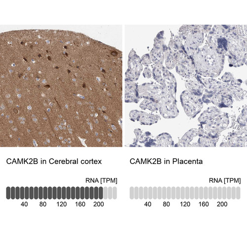 Immunohistochemistry analysis in human cerebral cortex and placenta tissues using HPA026307 antibody. Corresponding CAMK2B RNA-seq data are presented for the same tissues.