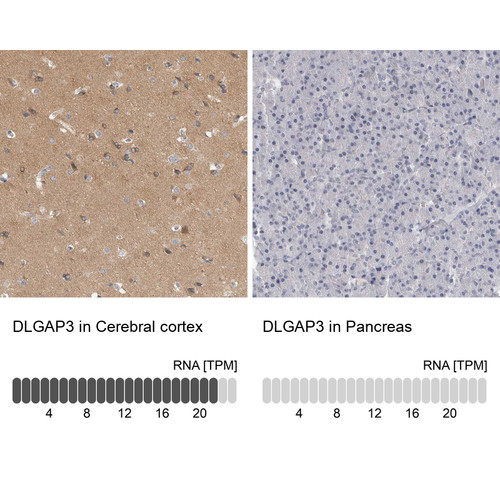 Immunohistochemistry analysis in human cerebral cortex and pancreas tissues using Anti-DLGAP3 antibody. Corresponding DLGAP3 RNA-seq data are presented for the same tissues.