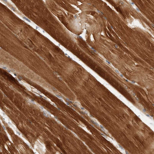Immunohistochemical staining of human skeletal muscle shows strong cytoplasmic positivity.