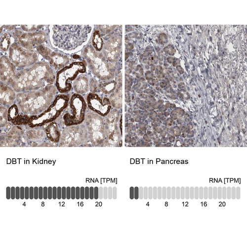Immunohistochemistry analysis in human kidney and pancreas tissues using Anti-DBT antibody. Corresponding DBT RNA-seq data are presented for the same tissues.