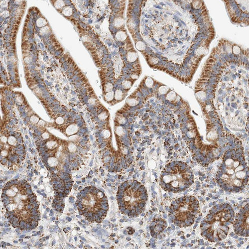 Immunohistochemical staining of human colon shows strong granular cytoplasmic positivity in glandular cells.