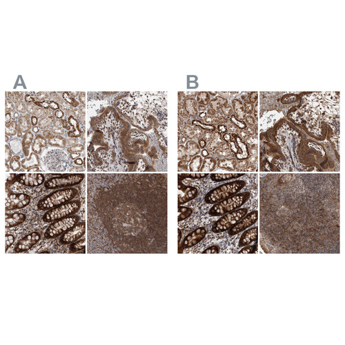 Immunohistochemical staining of human colon, kidney, liver and lymph node using Anti-DARS2 antibody HPA026528 (A) shows similar protein distribution across tissues to independent antibody HPA026506 (B).