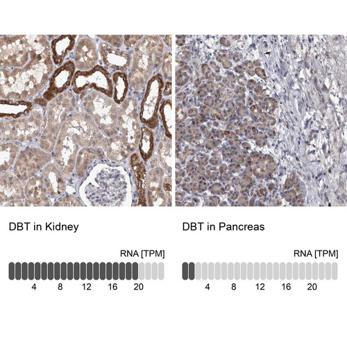 Immunohistochemistry analysis in human kidney and pancreas tissues using Anti-DBT antibody. Corresponding DBT RNA-seq data are presented for the same tissues.