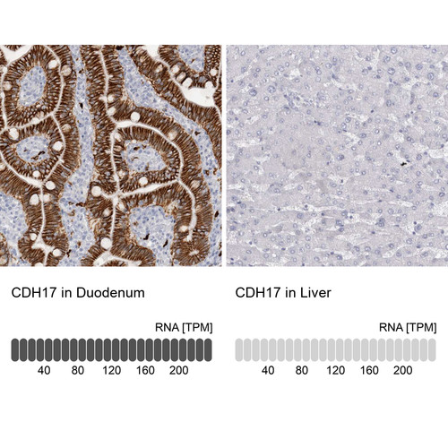 Immunohistochemistry analysis in human duodenum and liver tissues using HPA026556 antibody. Corresponding CDH17 RNA-seq data are presented for the same tissues.