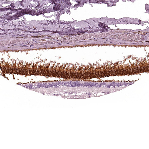 Immunohistochemical staining of human retina shows strong cytoplasmic and nuclear positivity in photoreceptor cells.