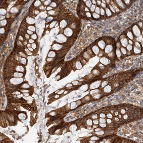Immunohistochemical staining of human colon shows strong cytoplasmic positivity in glandular cells.